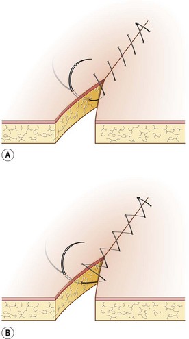 <p>Identify this suture pattern.</p>