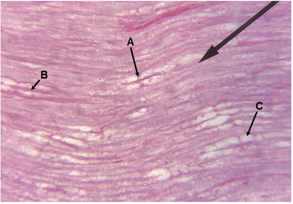 <p><span><span>In the image above, identify structures A-C. (Hint: B is purple, C is white.)</span></span></p>