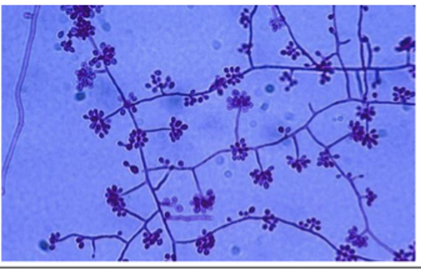 <p>A cat presents with ulcerated nodules along lymphatic tracts on the forelimb. Cytology reveals cigar-shaped yeast. Culture at 25°C produces fuzzy mold, while 35°C yields yeast-like colonies.Tape prep from mold shows flowerette arrangements of pyriform conidia.</p>