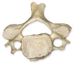 <p>What vertebrae is this?</p>