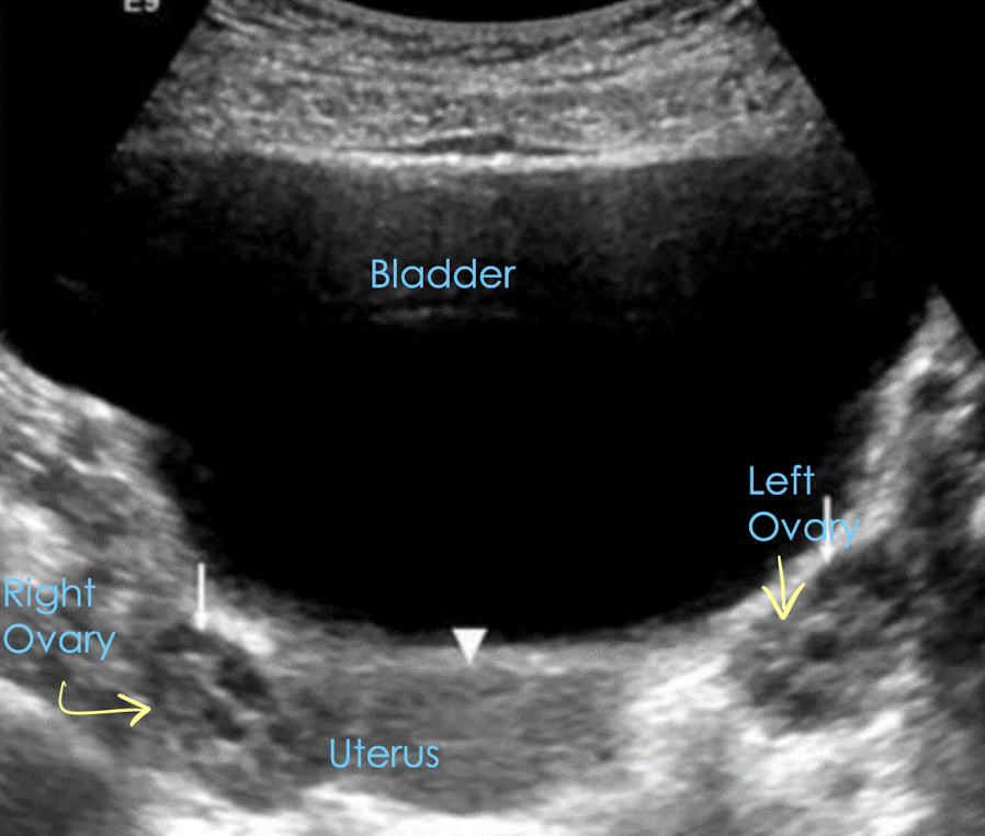 <p>TA pelvic anatomy in TRANS</p>