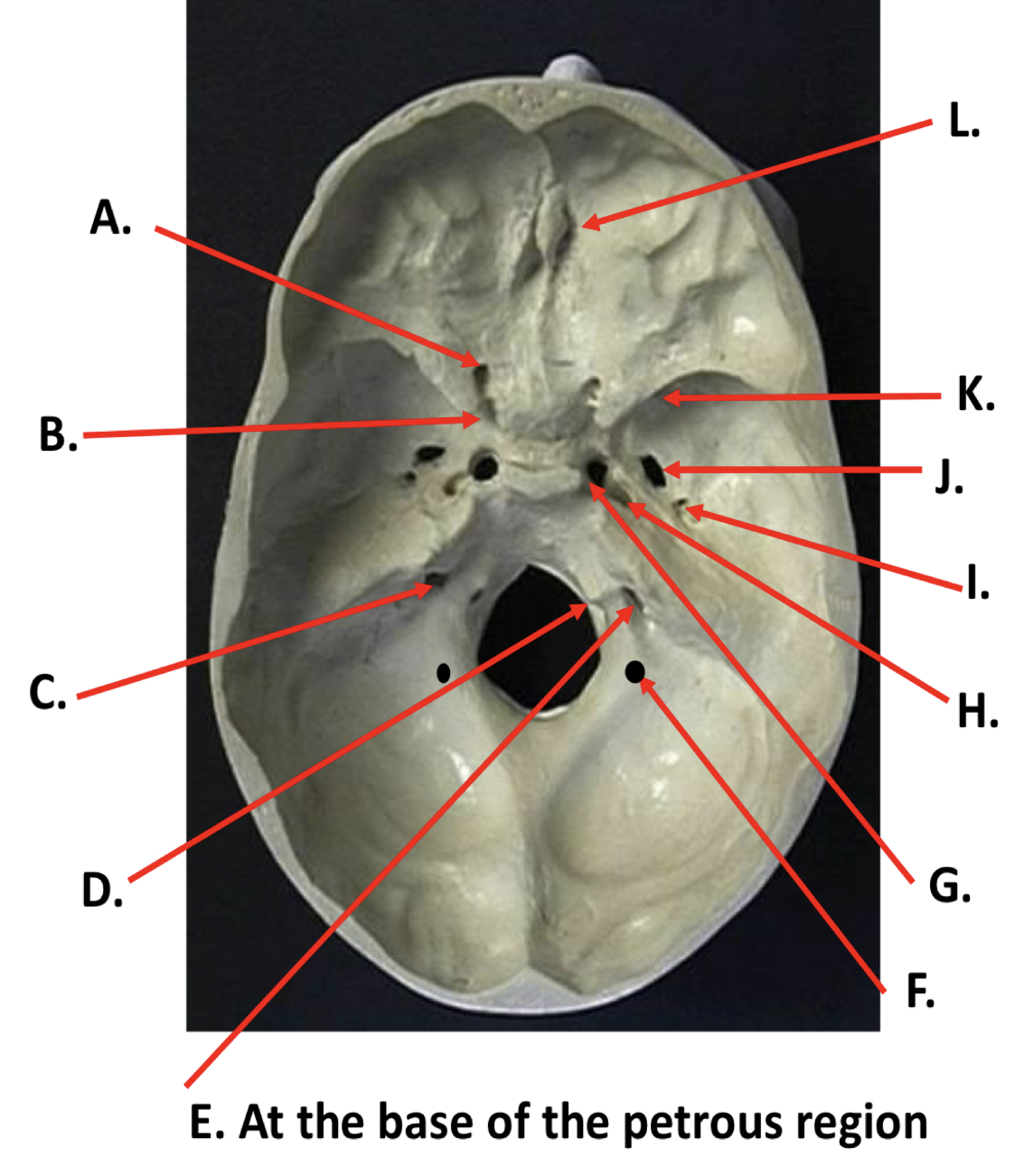 <p>J</p>