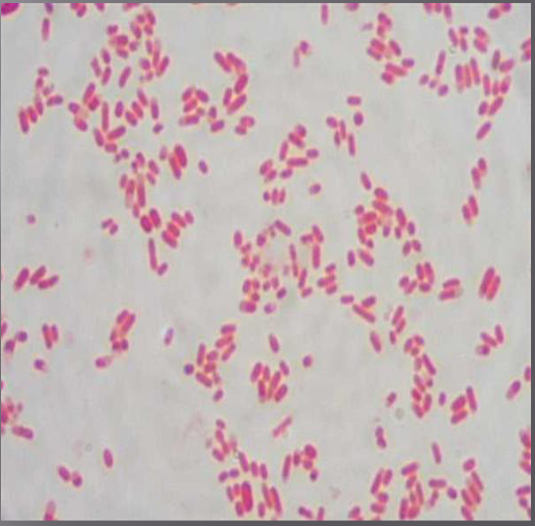 <ul><li><p>сем. Enterobacteriaceae, род Escherichia</p></li><li><p>грам-отрицателни прави пръчици</p></li><li><p><span><span>разположението на клетките е нехактерно – поединично, по двойки или в неправилни</span></span><br><span><span>формации</span></span></p></li><li><p><span><span>перитрихи, но се срещат и неподвижни щамове</span></span></p></li><li><p><span><span>не образуват спори</span></span></p></li><li><p><span><span>повечето образуват капсули или микрокапсули</span></span></p></li><li><p>аероби, факултативни анаероби</p></li><li><p>невзискателни</p></li></ul><p></p>