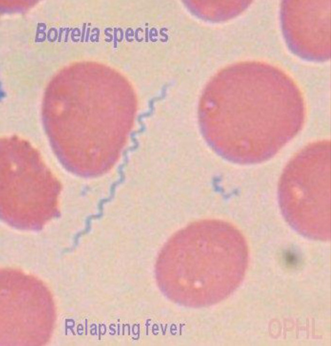 <p>Spirochetes</p>