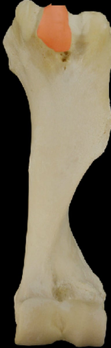 <p>intermediate tubercle</p><p>- makes the shoulder joint unable to flex</p><p>- tendon distance is fixed , cannot increase</p>