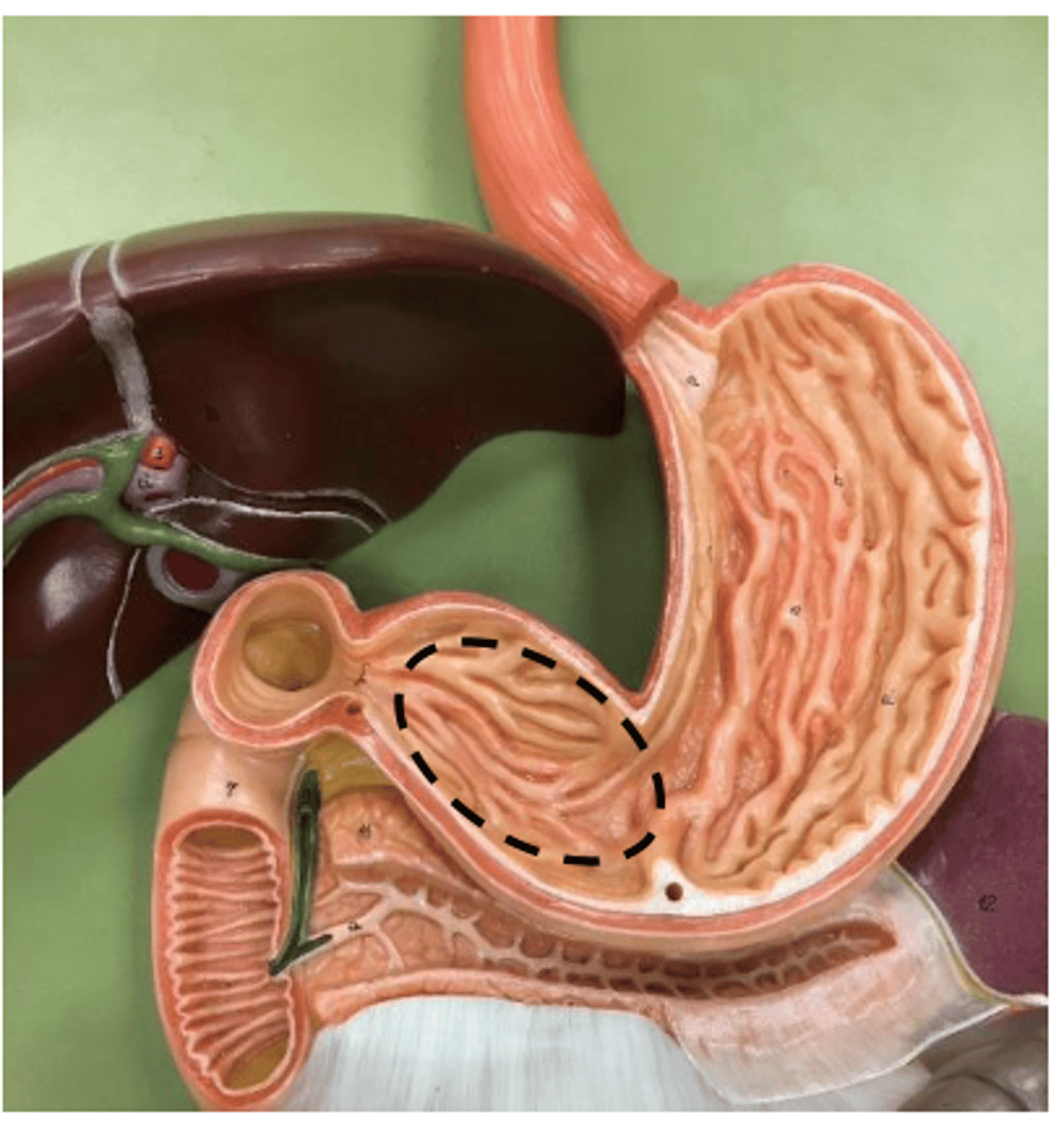 knowt flashcard image