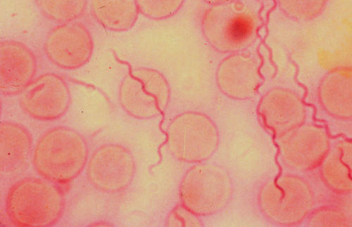 Gram negative, spirillum, motile, causes Lyme disease