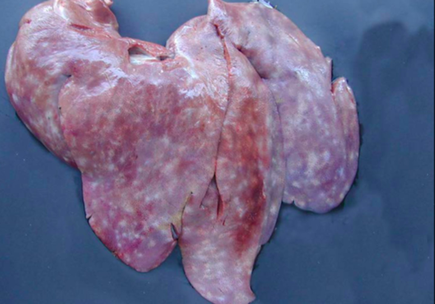 <p>Lever fra svin, hvad er den patoanatomiske diagnose og ætiologien?</p>
