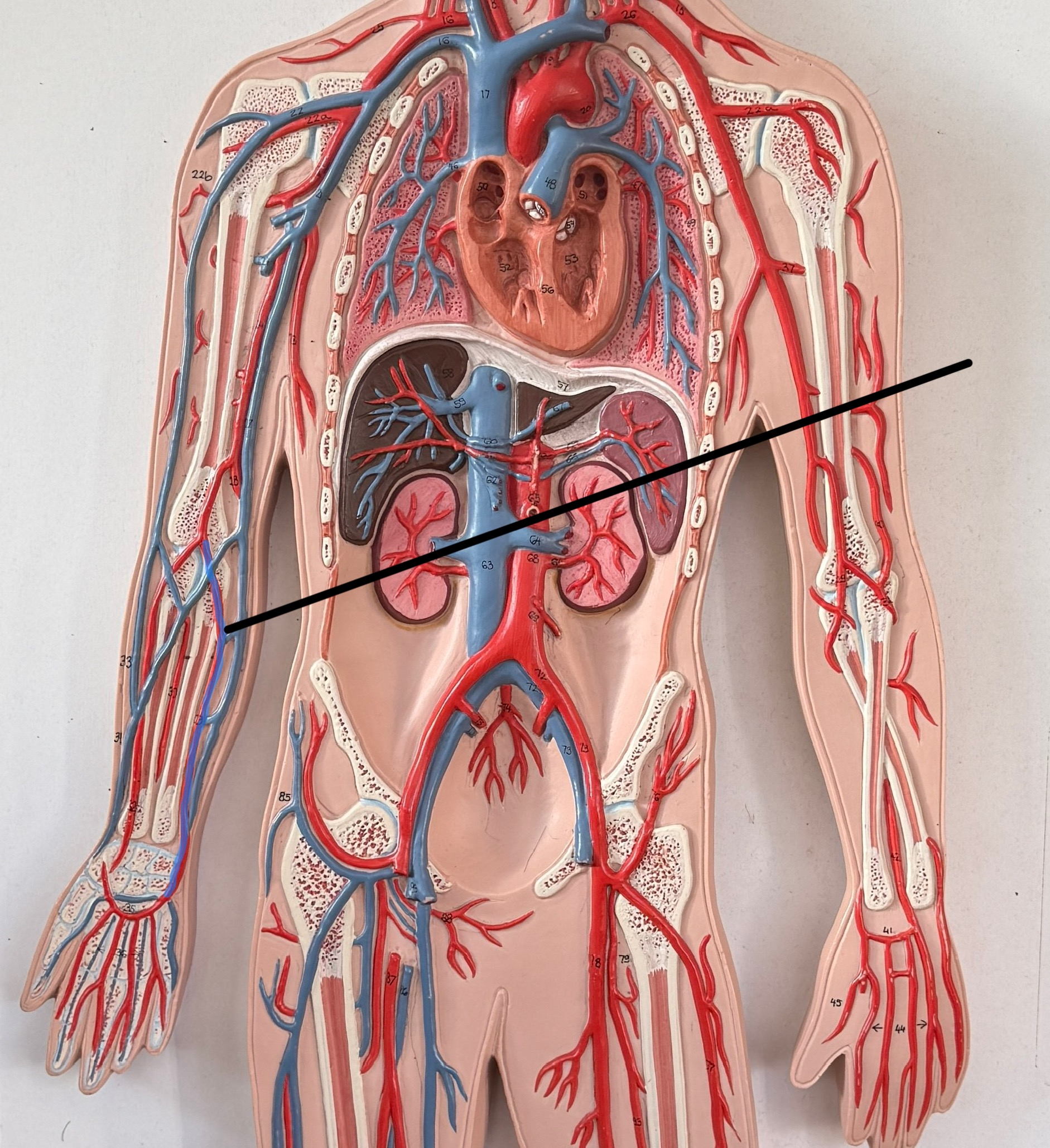<p>Which artery is this?</p>