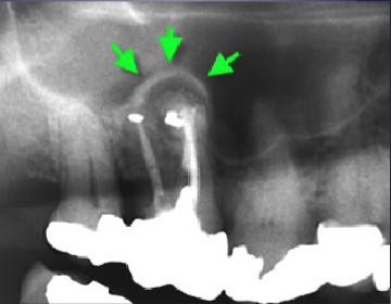 <p>what are the arrows pointing to </p>