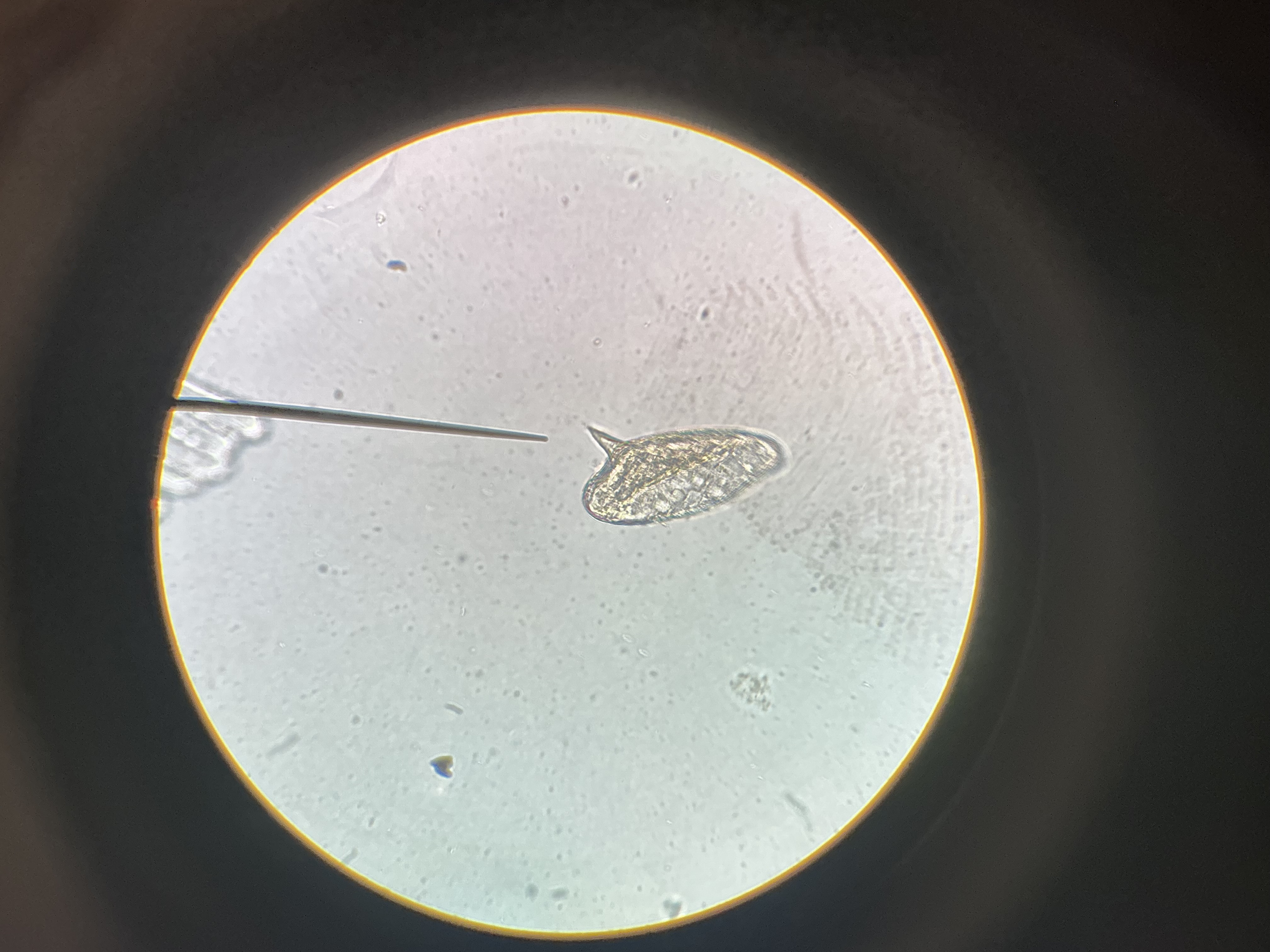 <p>Schistosoma mansoni</p>