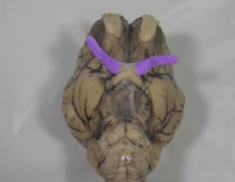 <p>Optic nerve </p>