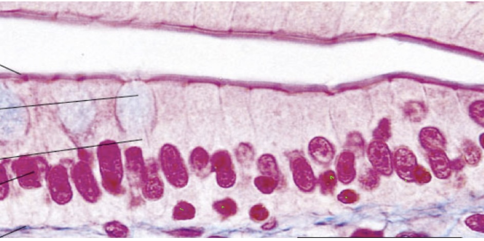 <p>single layer of tall cells</p><p>secretion and absorption</p><p>found in the small intestine</p>