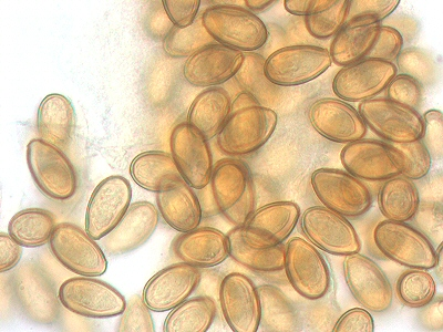 <p>Adaptations of Parasitism </p>