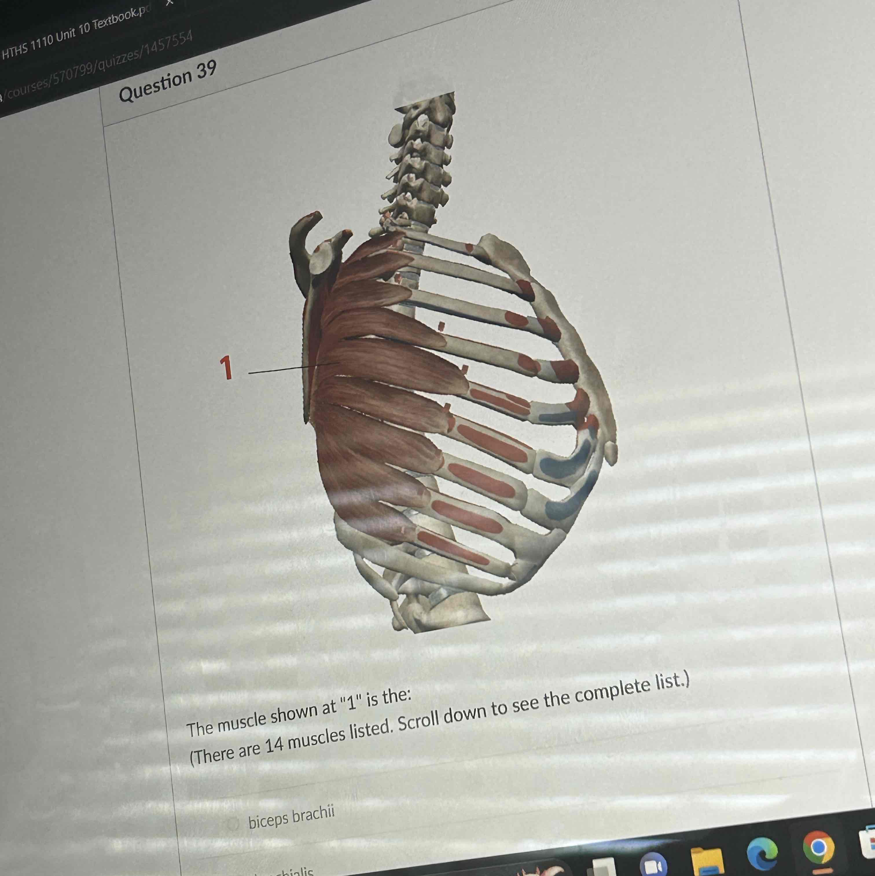 <p>The muscle shown at 1 is the </p>