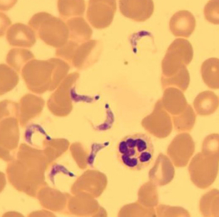 <p>Blood smear</p>