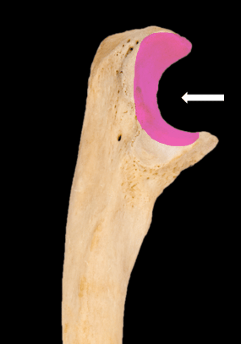 <p>name the part</p>