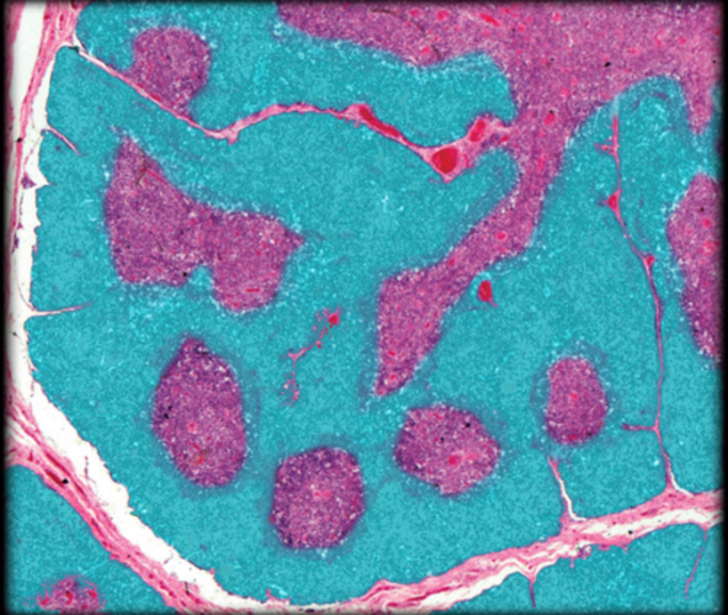 <p>Fetal thymus</p>