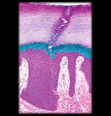 <p>What layer of the epidermis is highlighted</p>