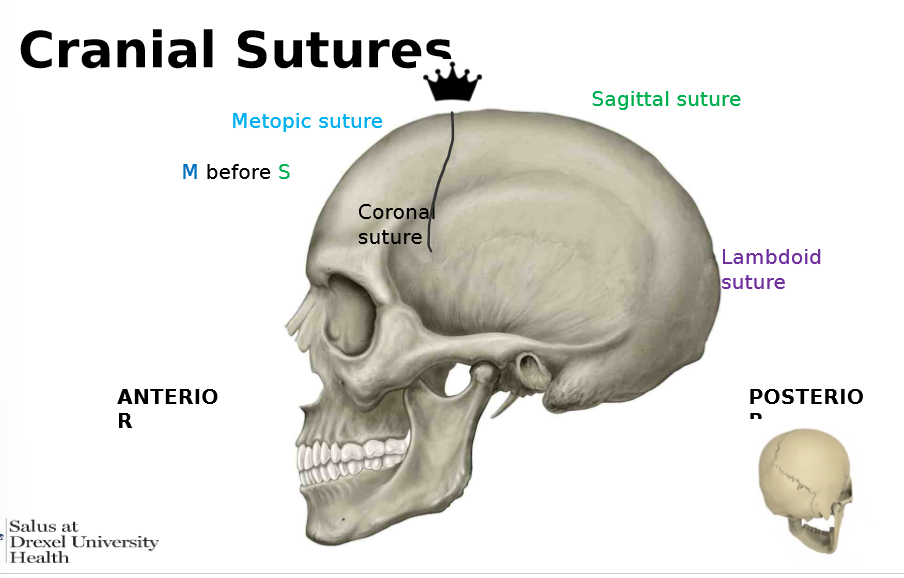 <ol><li><p><strong><u>m</u></strong>esopic suture </p></li><li><p>sagittal suture </p></li><li><p>lambdoid suture </p></li></ol><p></p>