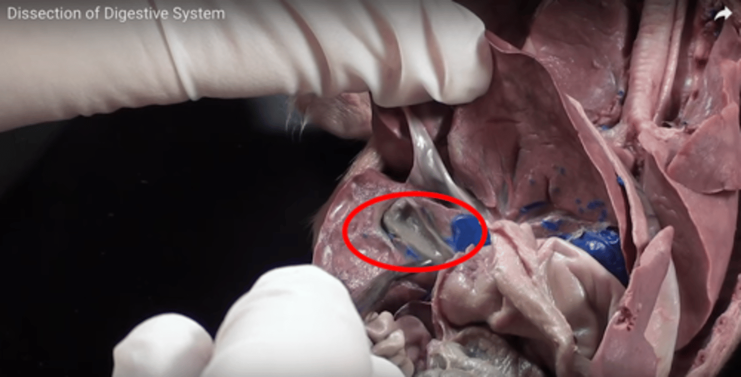 <p>What is the name of this structure? (Underneath the liver)</p>