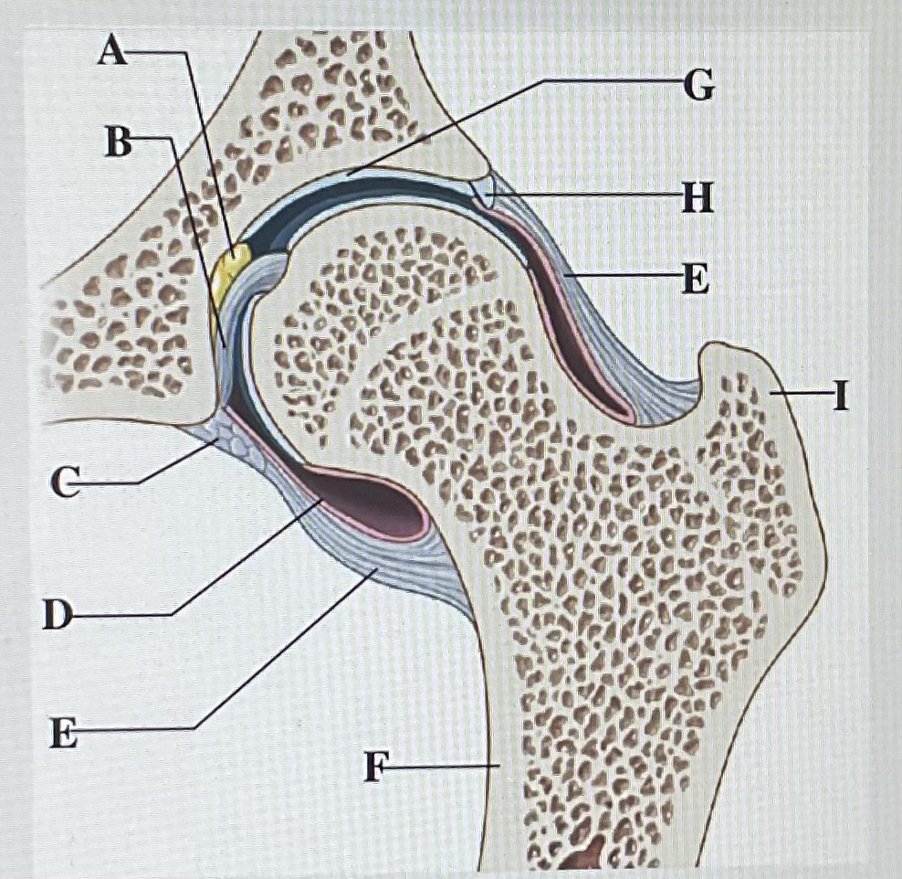 <p>in the image above letter ____ is the synovial membrane and letter ____ is the articular capsule </p>