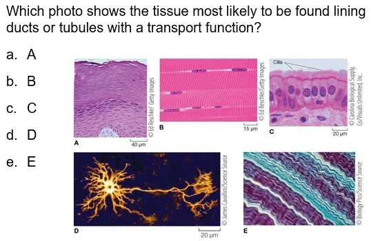 <p><span style="font-family: Arial">Which photo shows the tissue most likely to be found lining ducts or tubules with a transport function?</span></p>