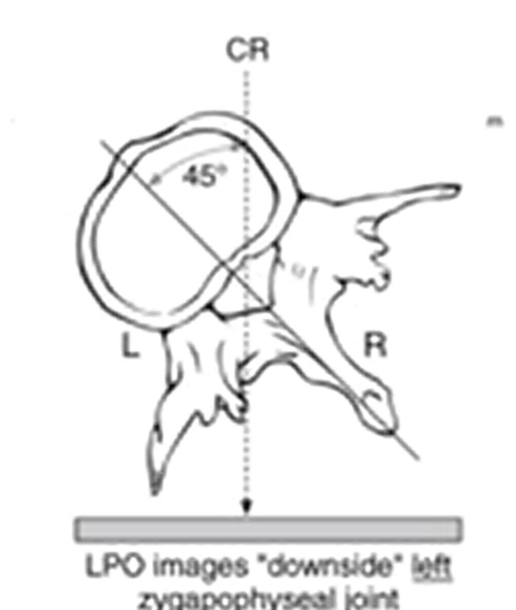 <p>the side closest to the image receptor or the side that is labeled</p><p>(posterior)</p>