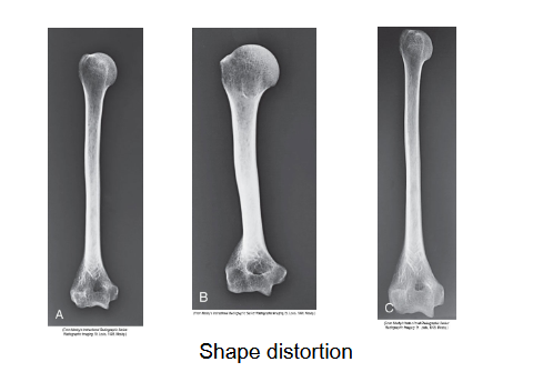 <p>What is happening with these bones</p>