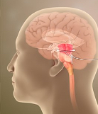 <p>Midbrain </p>