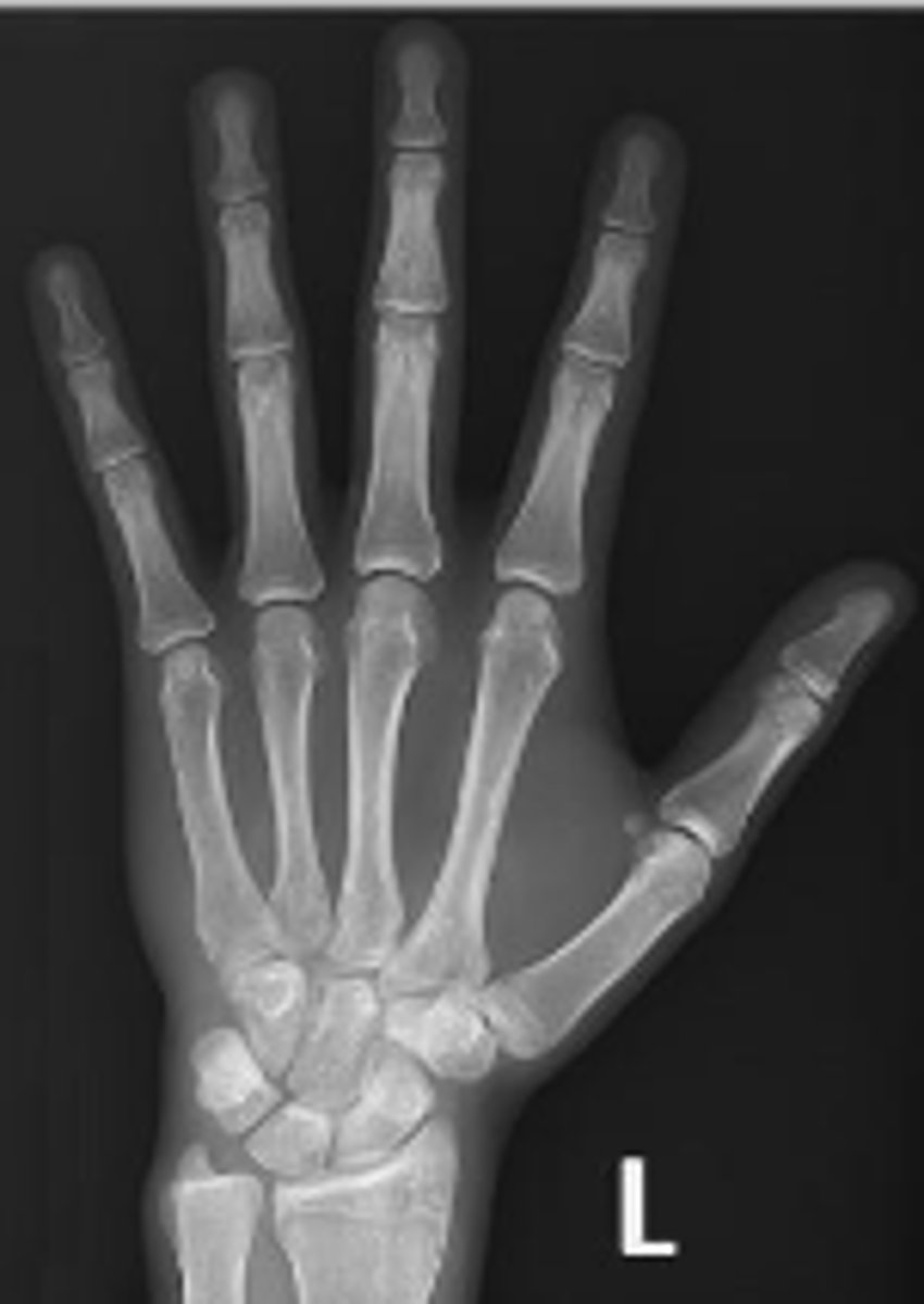 <p>What is the name of the radiographic view?</p>