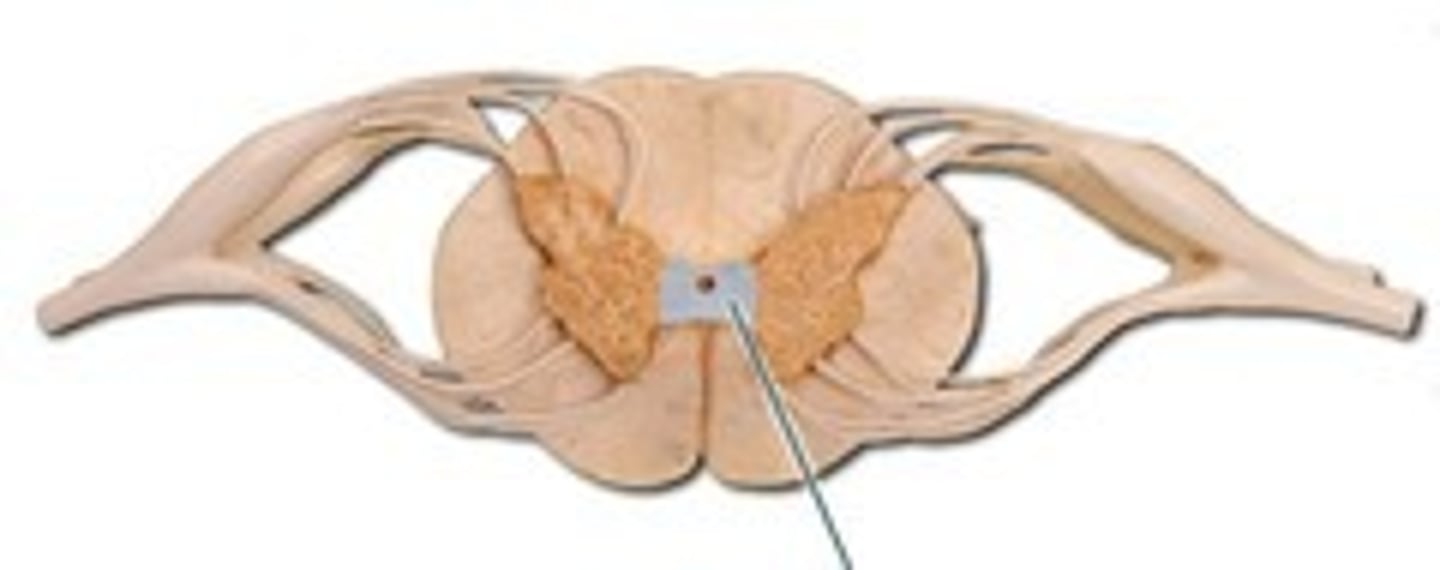 <p>any collection of axons that connect one side of the brain with the other side (cross midline) transversely in one spot</p>