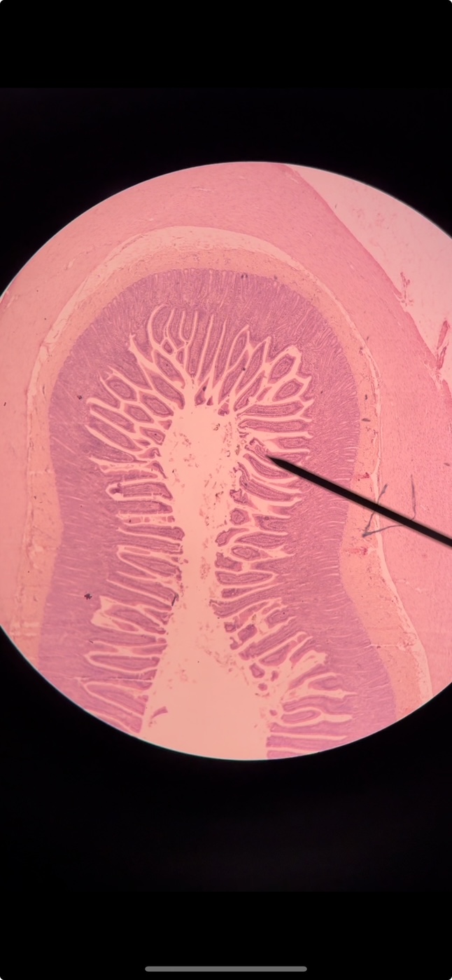 <p>Organ?</p><p>Region?</p>