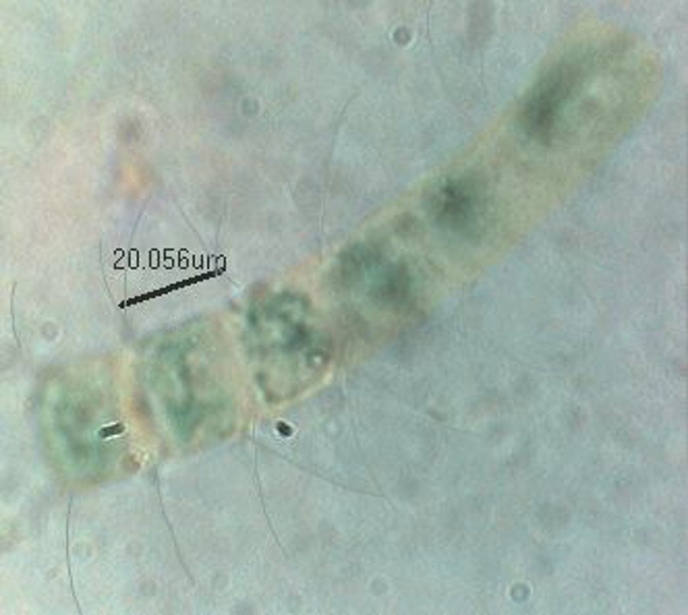 <p>Identify the marine Diatom shown</p>