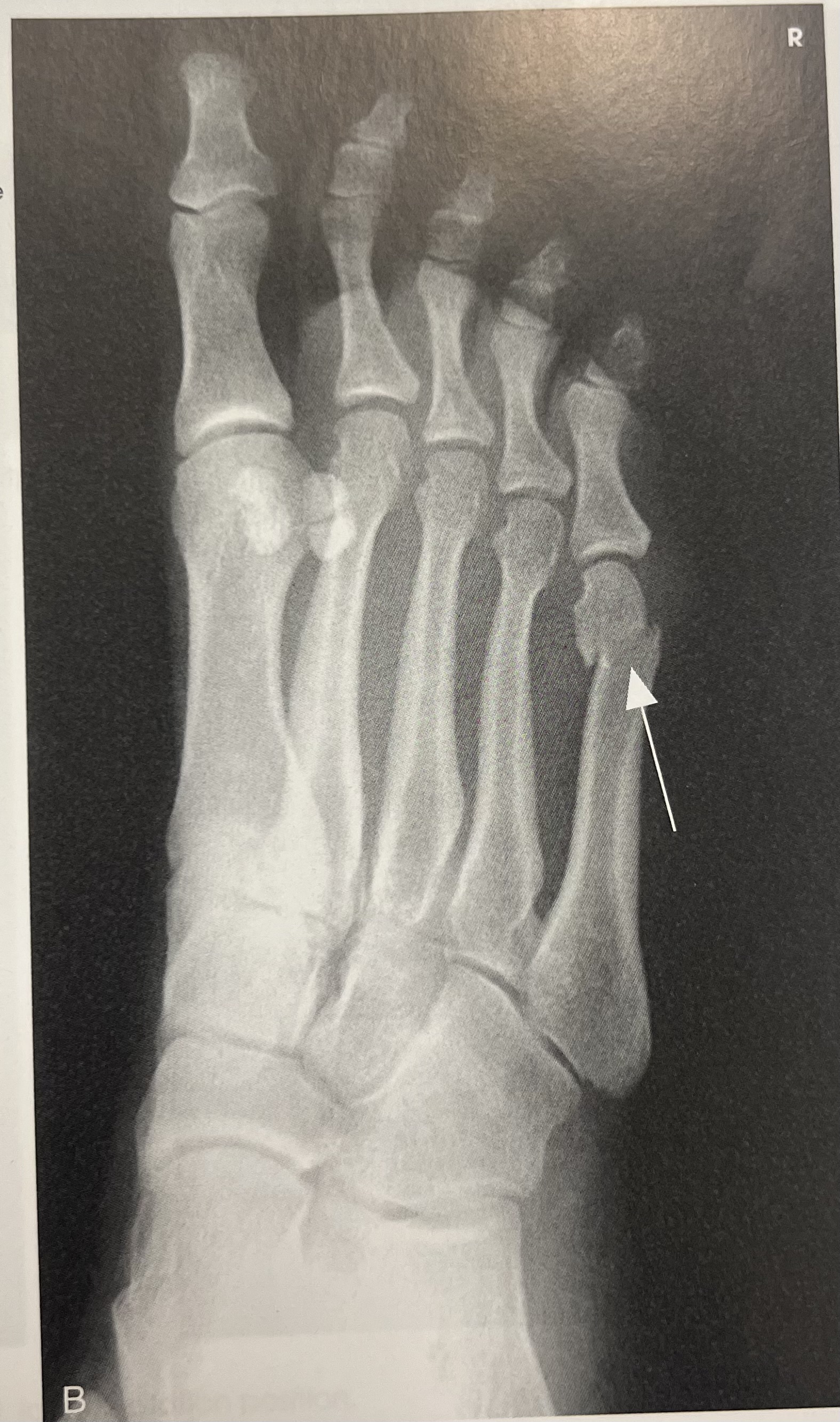 <p>identify part <strong>position</strong> of the image </p>