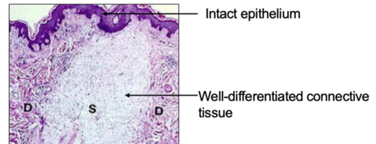 <p>after 1 month of a cutaneous wound, we see....</p>