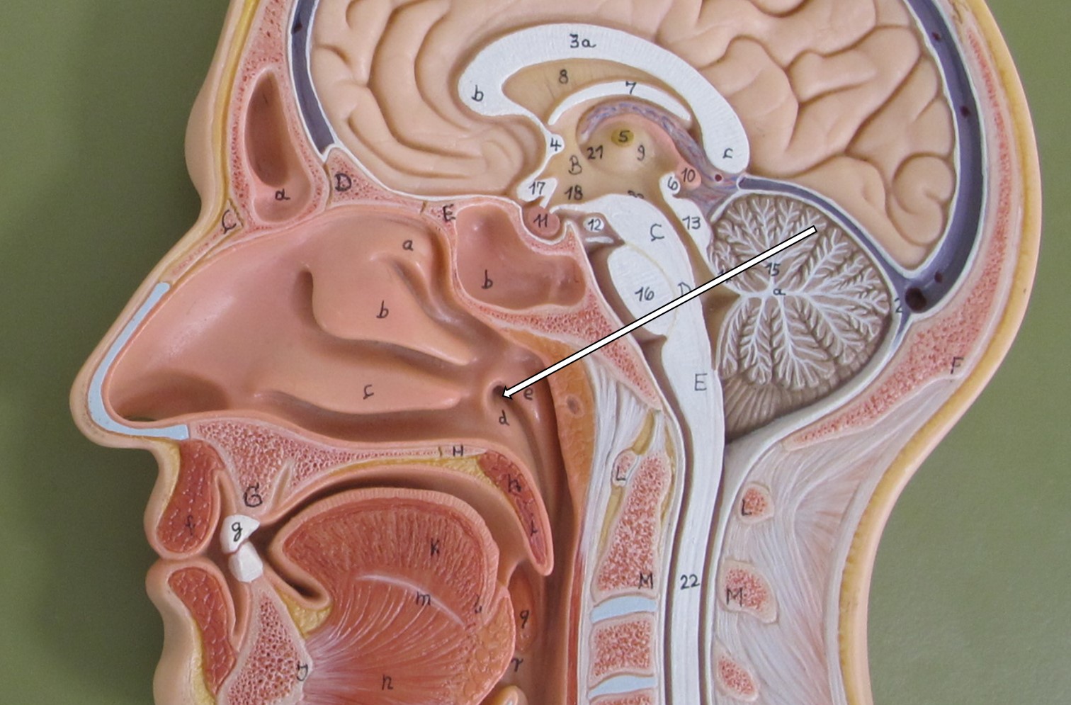 <p>Van welk kanaal wordt hier de opening aangeduid in de laterale wand van de nasopharynx? (Latijns)</p>