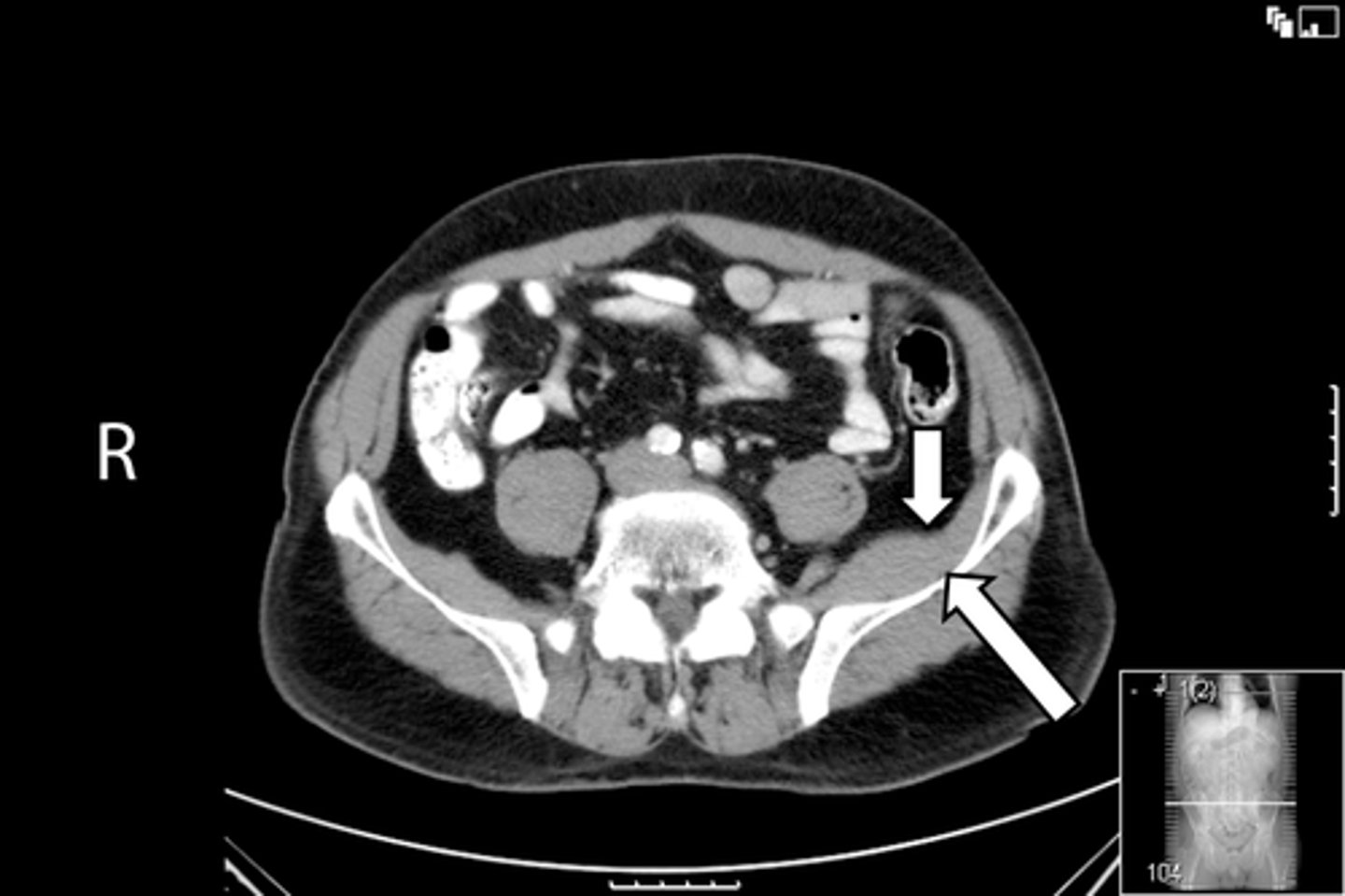 <p>What is indicated in the image?</p>