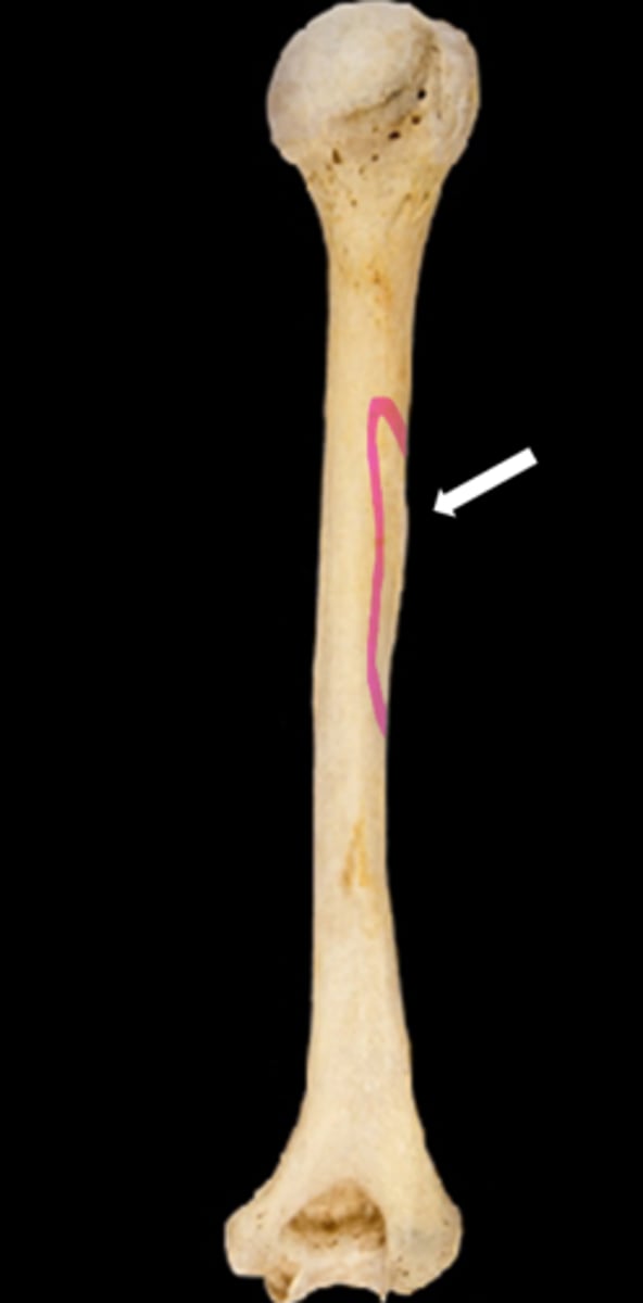 <p>name the part</p>