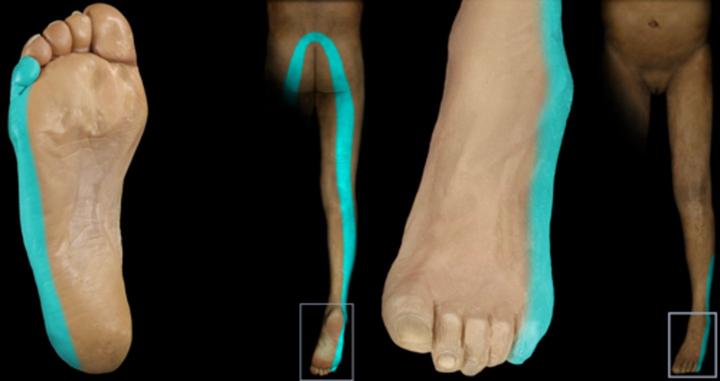 <p>Buttock pain, paresthesia down posterior leg to little toe, ↓ Achilles reflex, weakness in S1-innervated muscles (plantarflexors)</p>