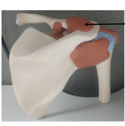 <p>What is the arrow pointing at on the shoulder?</p>
