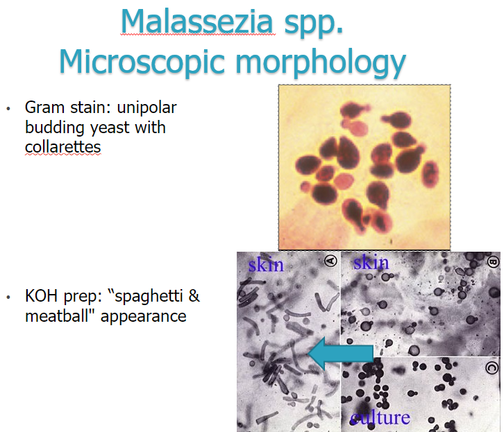 <p>Malassezia furfur req lipids → olive oil</p><p>fungal BC (pt &lt;1yr) → add olive oil</p><p>GST: unipolar budding yeast w collarettes, bowling pins or russian dolls</p><p>KOH prep: spaghetti &amp; meatballs</p>