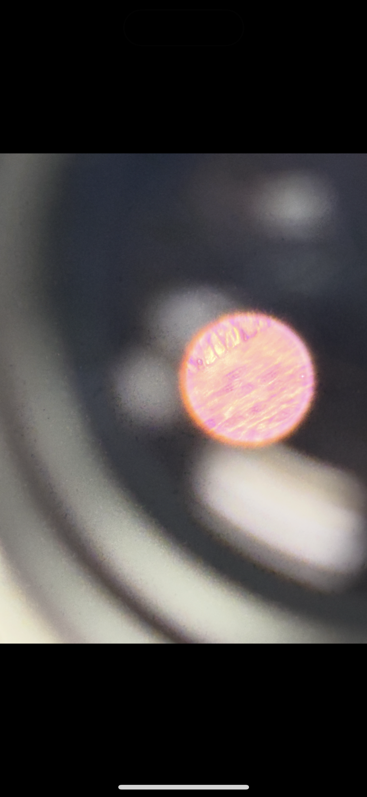 <p>Body location: blood vessel wall</p>