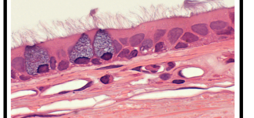<p>Function: Moves mucus </p><p>Location: Respiratory Tract Lining </p>