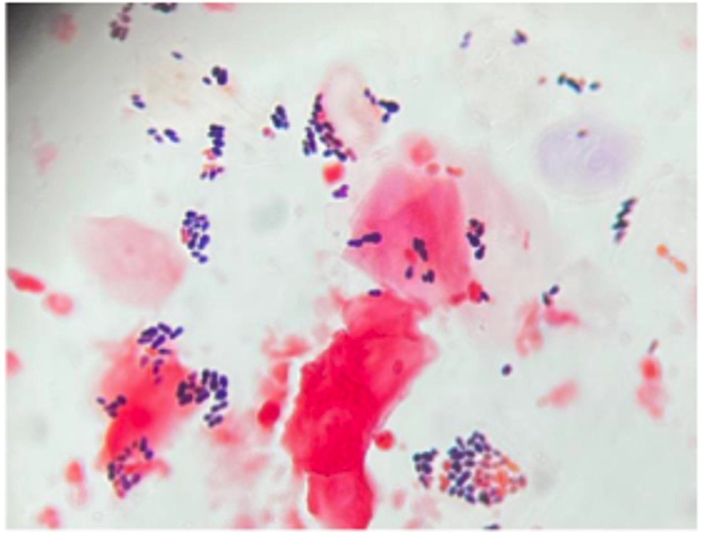 <p>A Basset Hound presents with chronic smelly otitis</p>