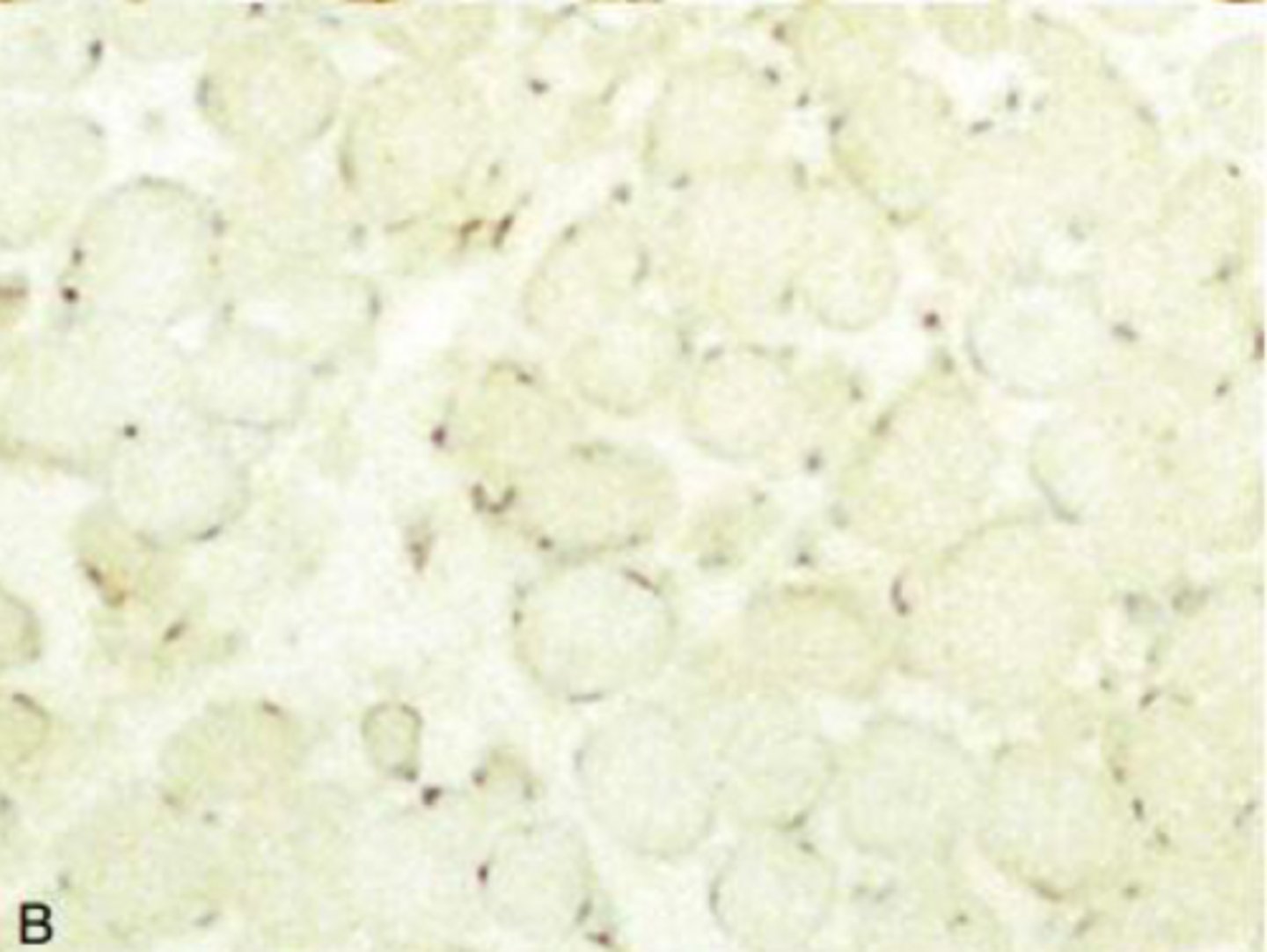 <p>How is X-linked muscular dystrophy in dogs DX?</p>