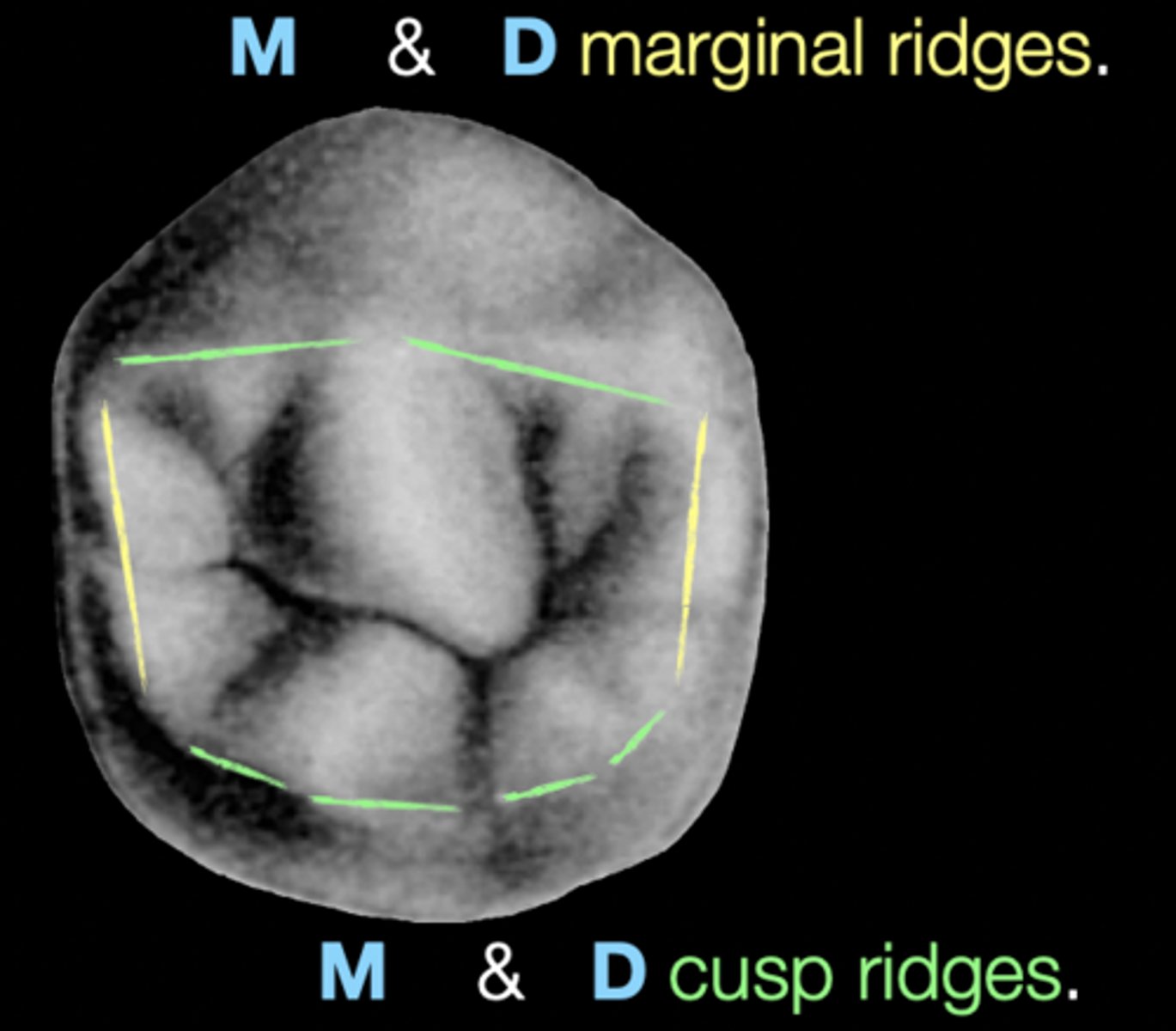 <p>occlusal surface that is bounded by the continuous cusp ridges &amp; marginal ridges</p>