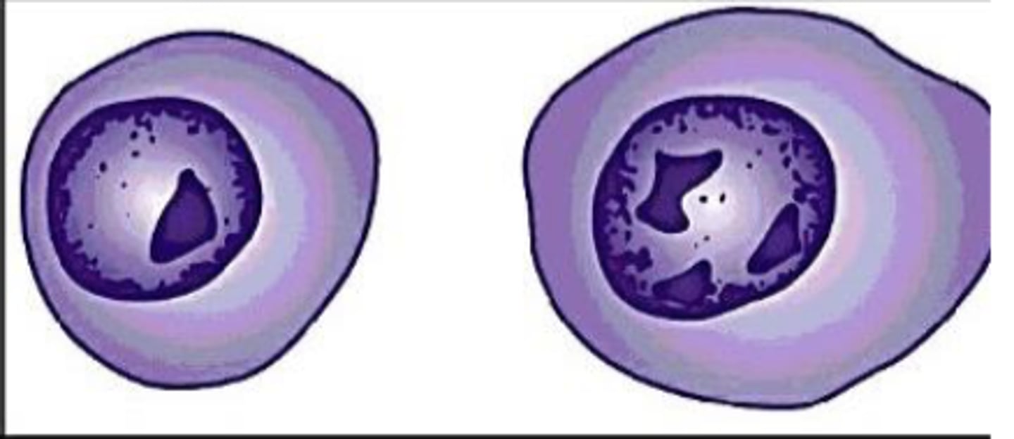 <p>What term is used for nucleoli that have fused?</p>