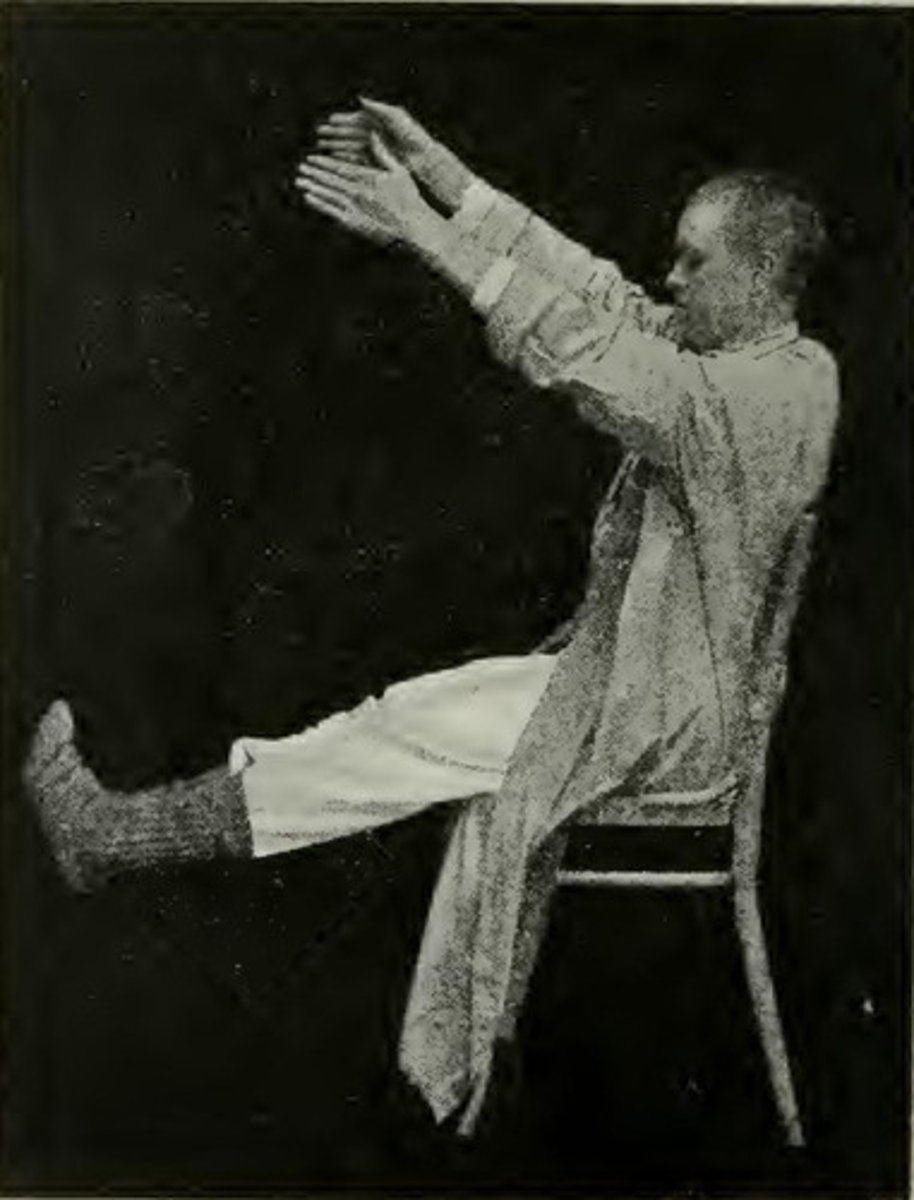 <p>periods of extreme restlessness and excessive and apparently purposeless motor activity (positive symptom)</p>