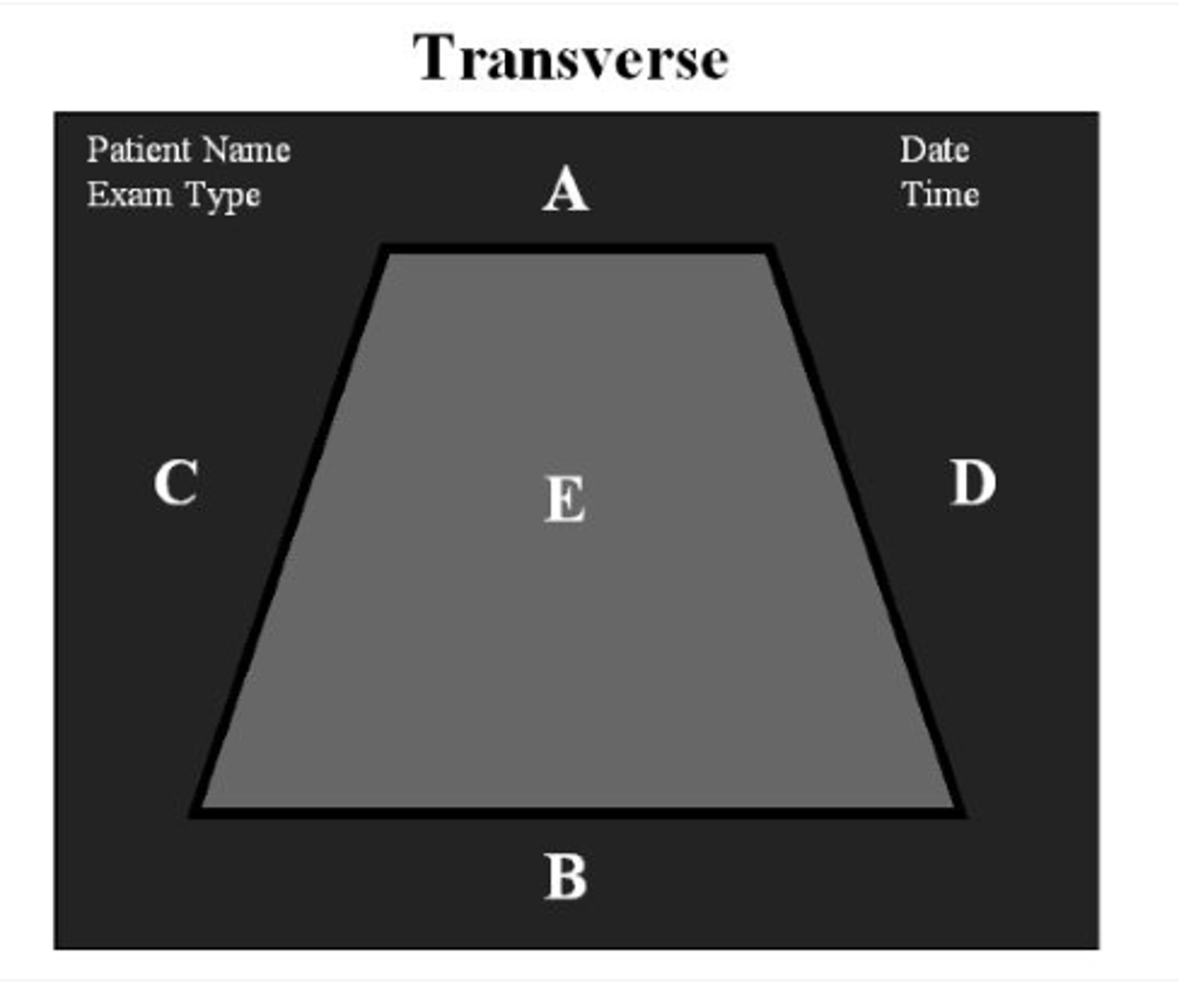 <p>For correct orientation when performing a transverse scan through the left thyroid, which letter represents the patient's right side?</p><p>a. a</p><p>b. b</p><p>c. c</p><p>d. d</p><p>e. e</p>